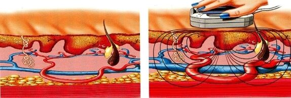 ak vám znecitlivia nohy